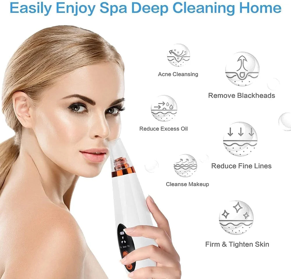 Vacuum Blackhead Remover | Deep Pore Cleansing Device