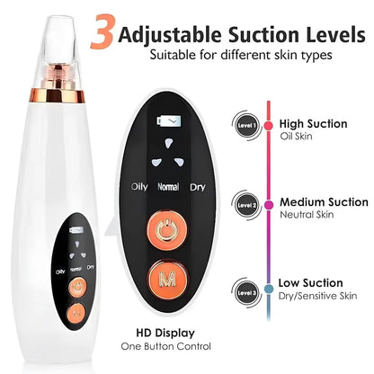 Vacuum Blackhead Remover | Deep Pore Cleansing Device
